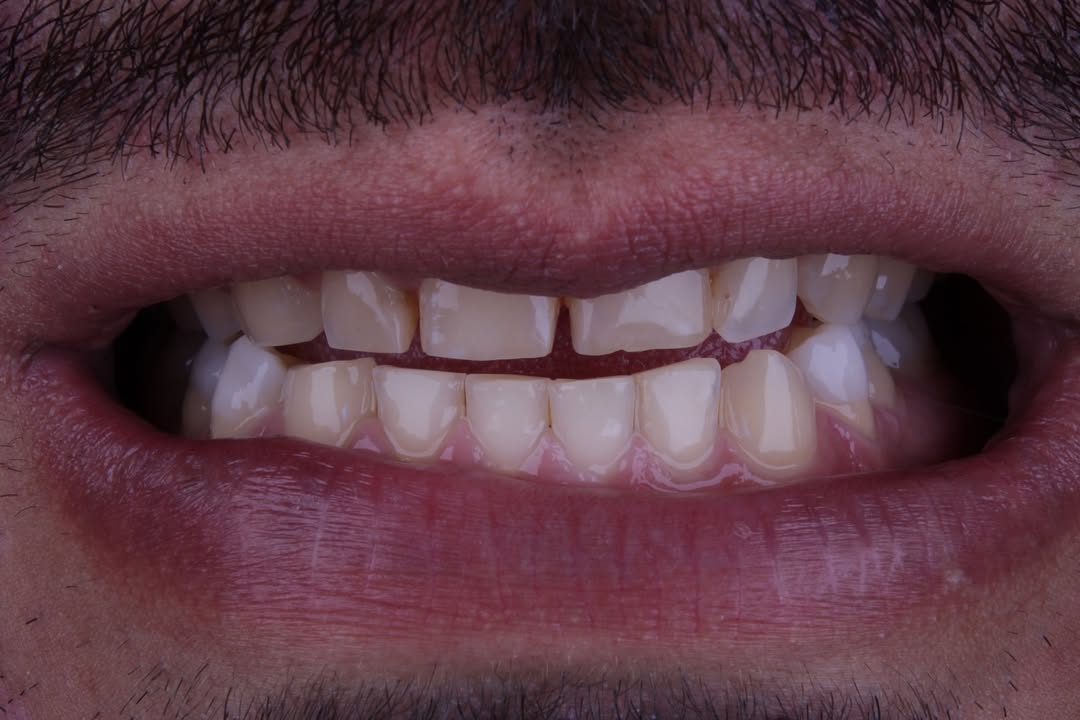 Antes do tratamento 1