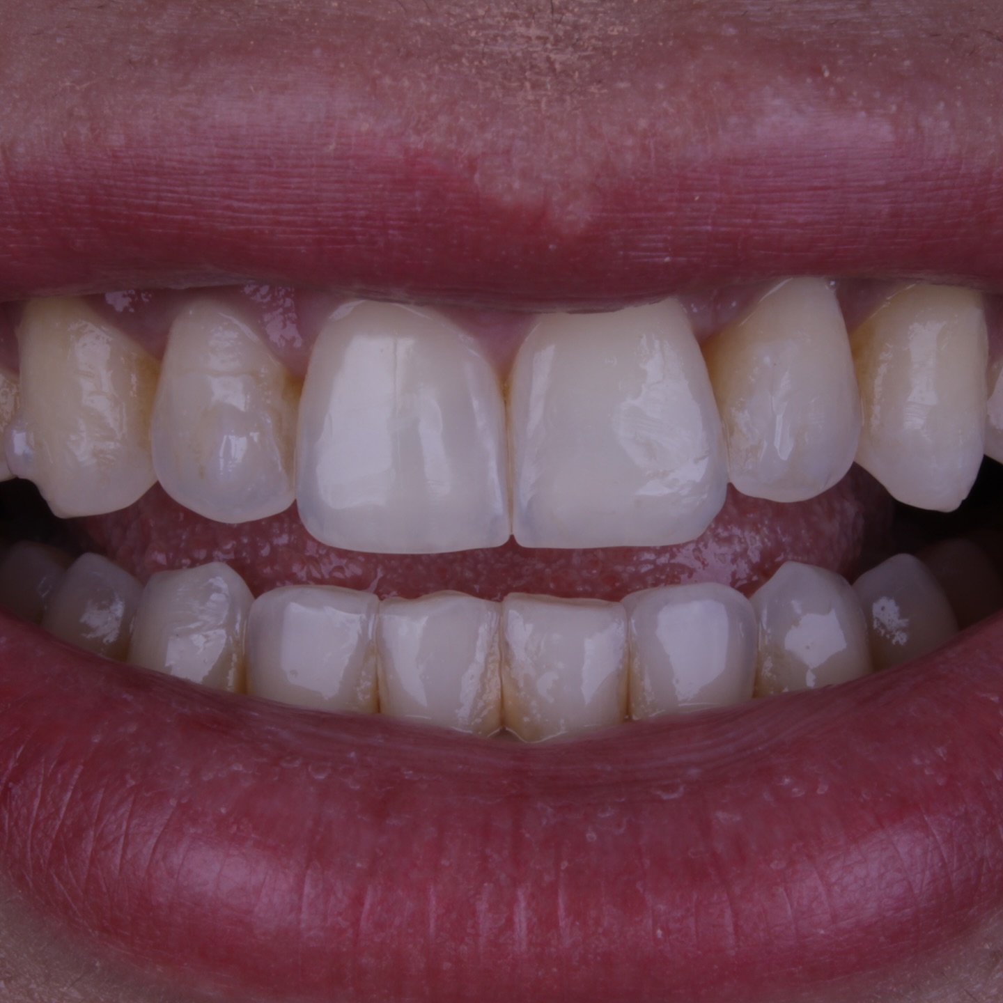 Antes do tratamento 2