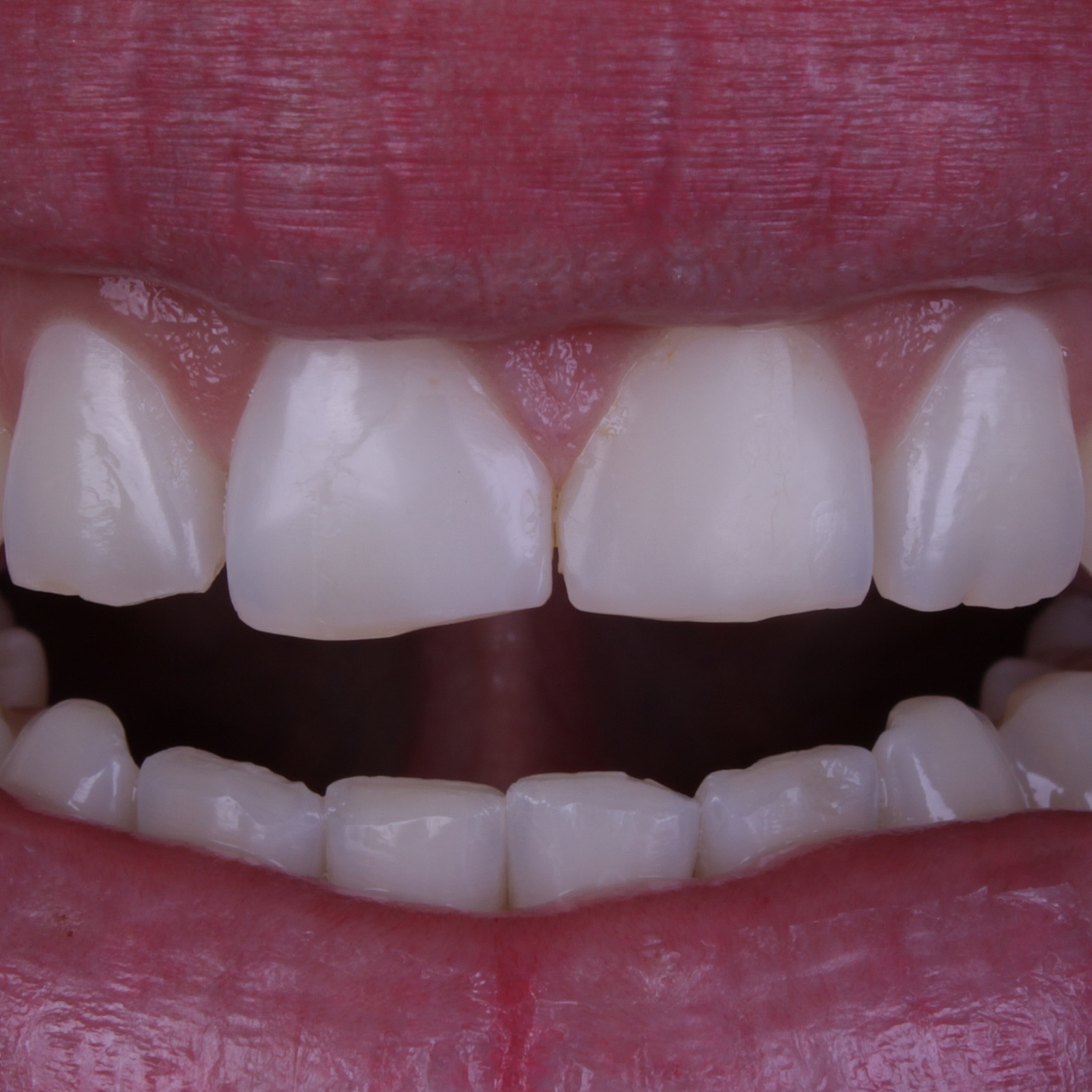 Antes do tratamento 3