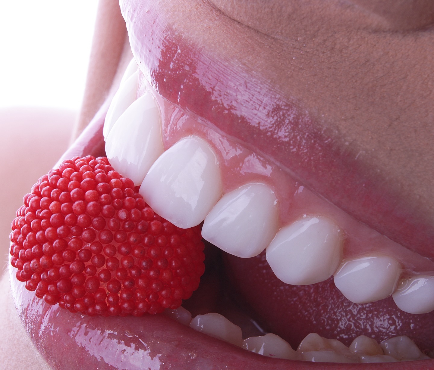 Facetas e lentes de porcelana